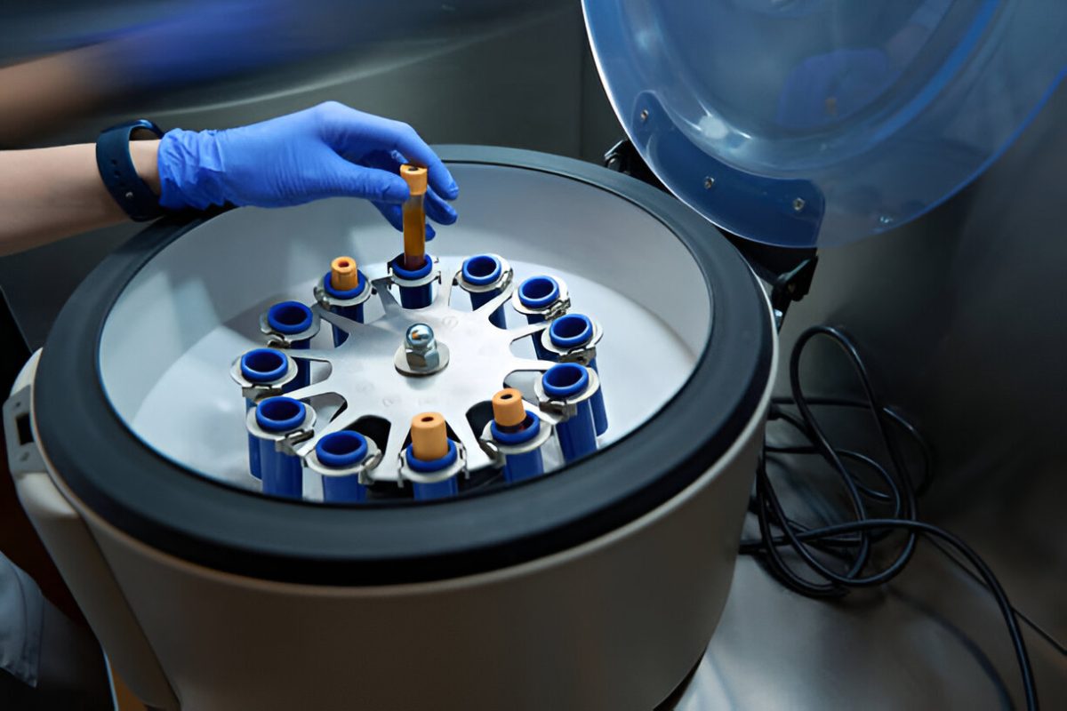 Cryogenic IVF Shipping in Asia