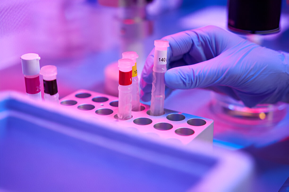 Cryogenic IVF Shipping in Asia