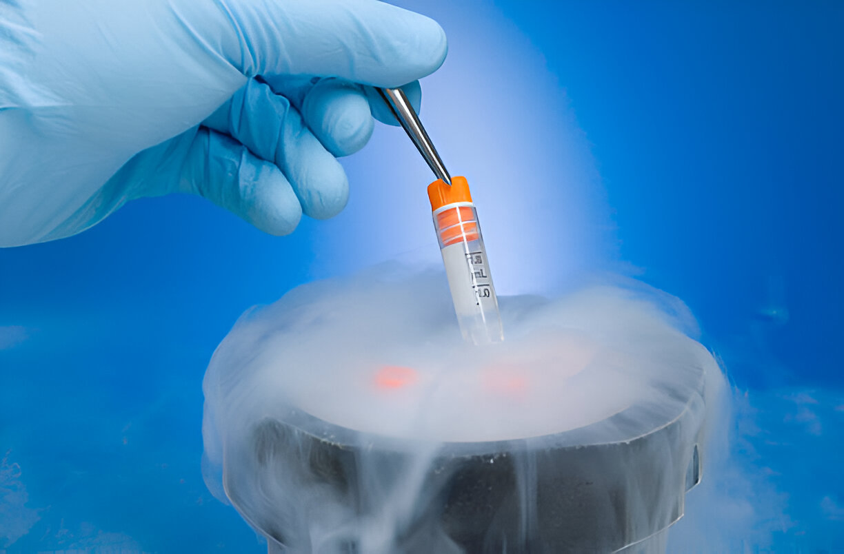 Best Cryo Shipping Company