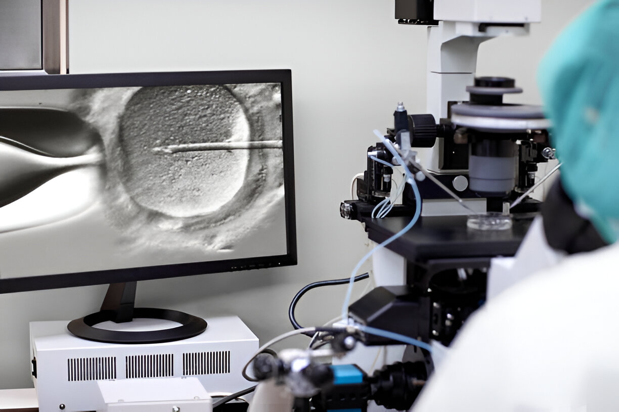 IVF Shipping in Irvine
