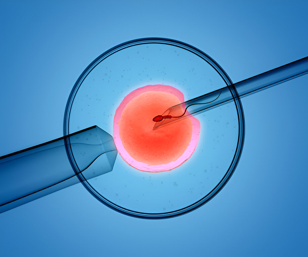 IVF Shipping in San Francisco