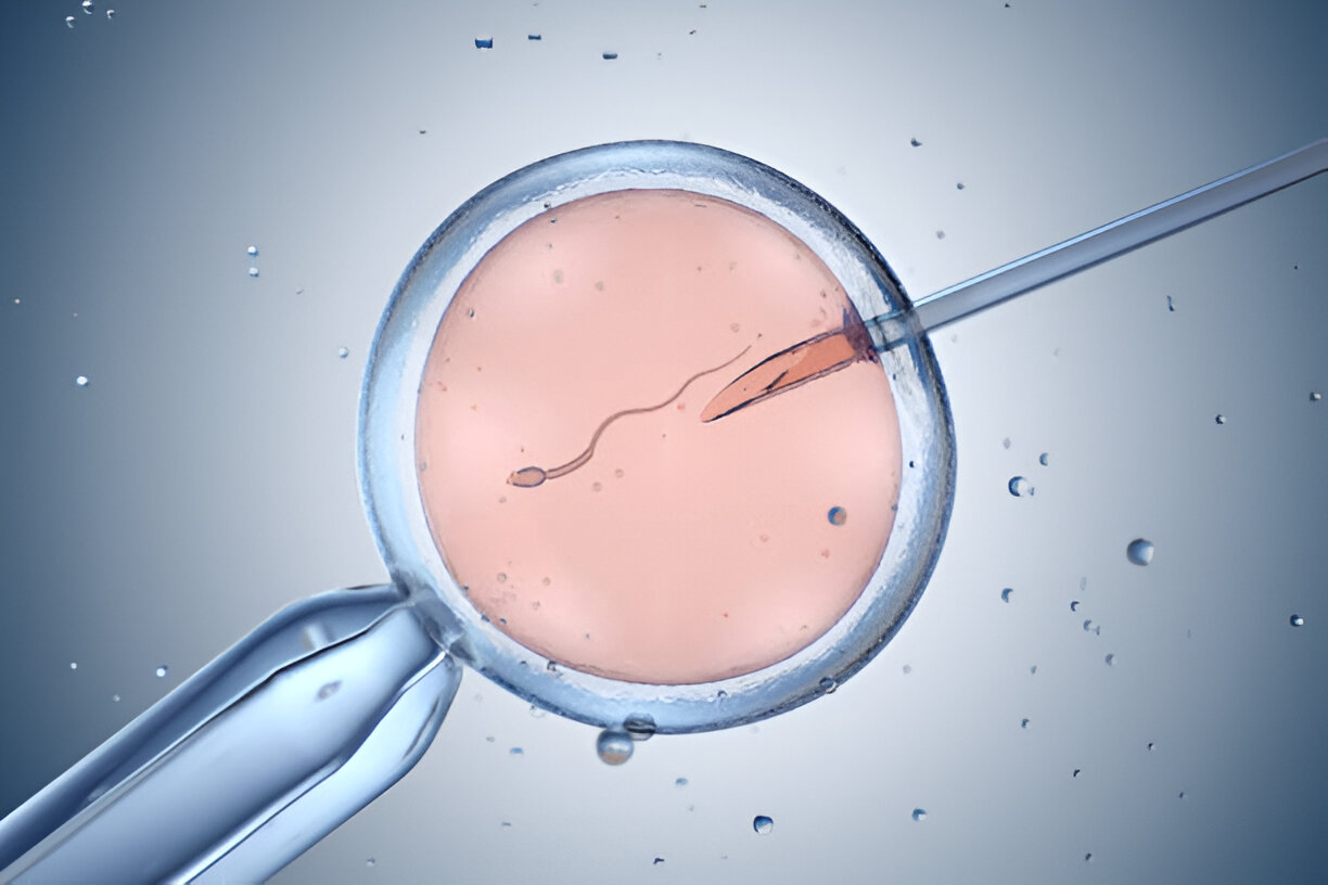 International Sperm Shipping