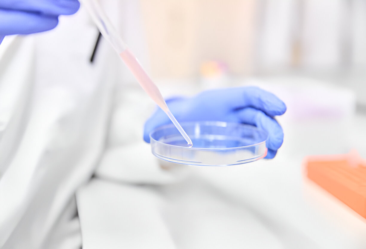 Cryogenic IVF Shipping Boston